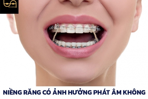 nieng-rang-co-anh-huong-den-phat-am-khong